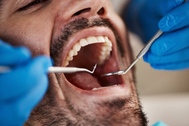 Best Dental Abscess Treatment in Ampere North, NJ
