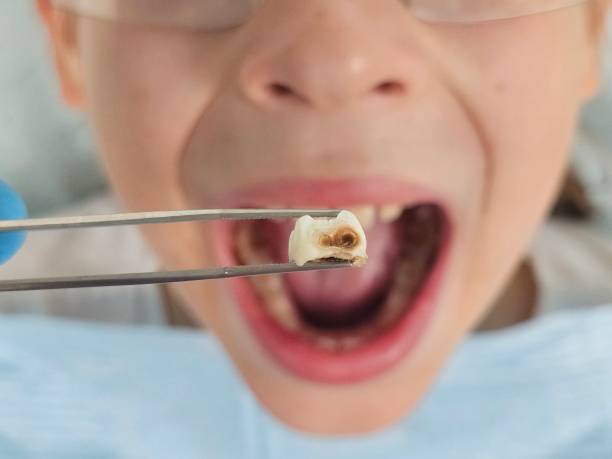 Best Emergency Pediatric Dental Care in Ampere North, NJ